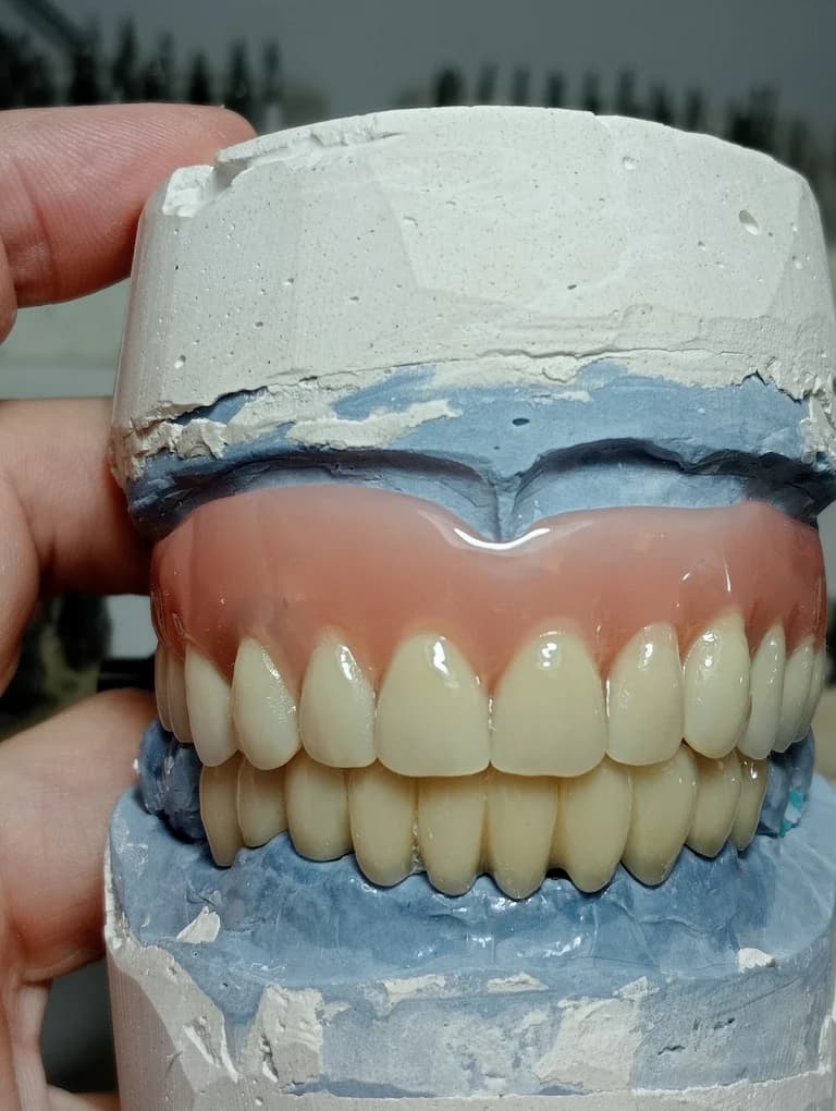 Prótesis dental completa superior e inferior sobre modelo de trabajo, fabricada por Marsadent